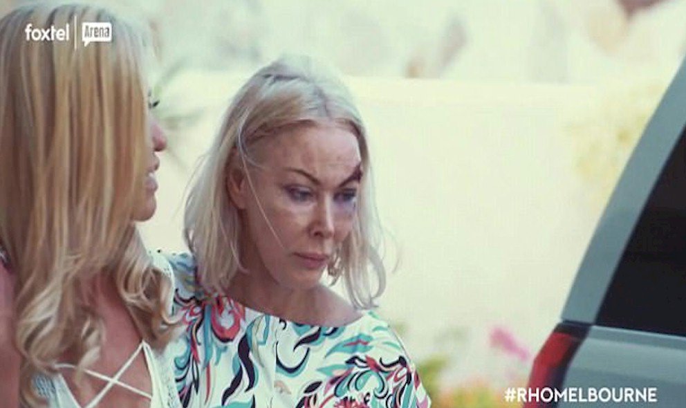 LALATE's tweet photo. What is going on?

🇦🇺 #LALATE 🇦🇺 #WORLDEXCLUSIVE 
#RHOMelbourne Controversy
Not ONE but TWO #JanetRoach #BlackEye Australian News Articles Yanked! 
https://t.co/45zxq91vjh
"Real Housewives" "Real Housewives of Melbourne" #RealHousewives https://t.co/W9xWfvRXUO