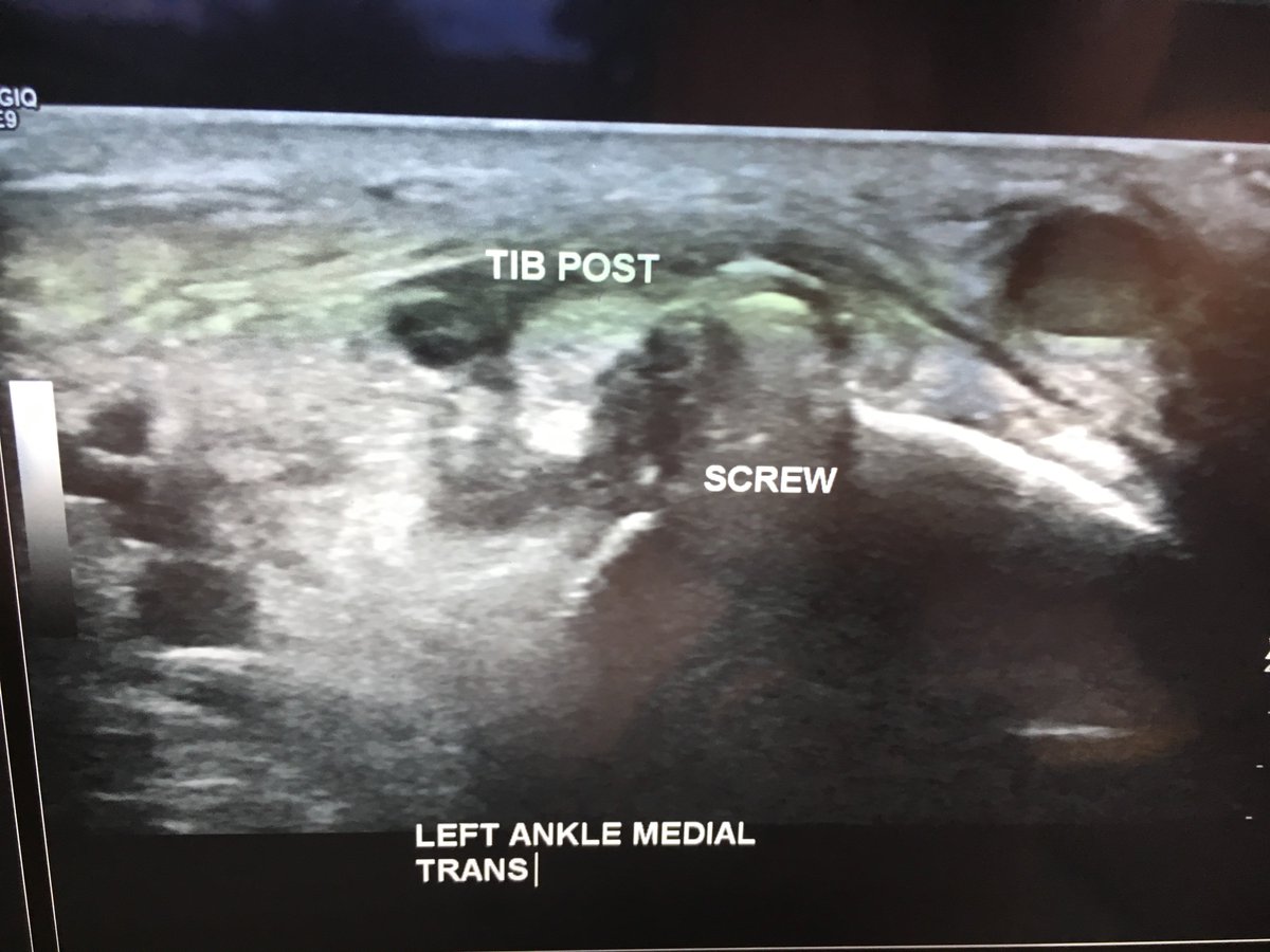 Neurodynamics's tweet photo. The DANGER of IGNORING NOCICEPTION: Read THIS:
This patient is a CHRONIC PAIN SUFFERER
https://t.co/s4d76ookiu https://t.co/Q2LzrGQVB6