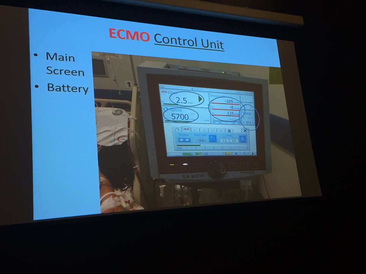 demetdevrimsel's tweet photo. #ACEM2017 #ECMOWORKSHOP if P1,P2 are high it can mean trombi in the oxygenator line, if P3 is high, think about afterload problems https://t.co/Br4RsTC6lz