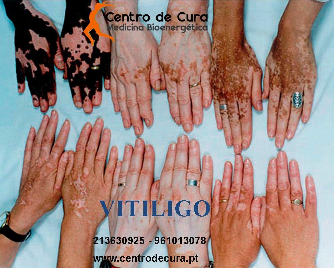 Centro de Cura - Terapias Bioenergéticas (@centrodecura) on Twitter photo 