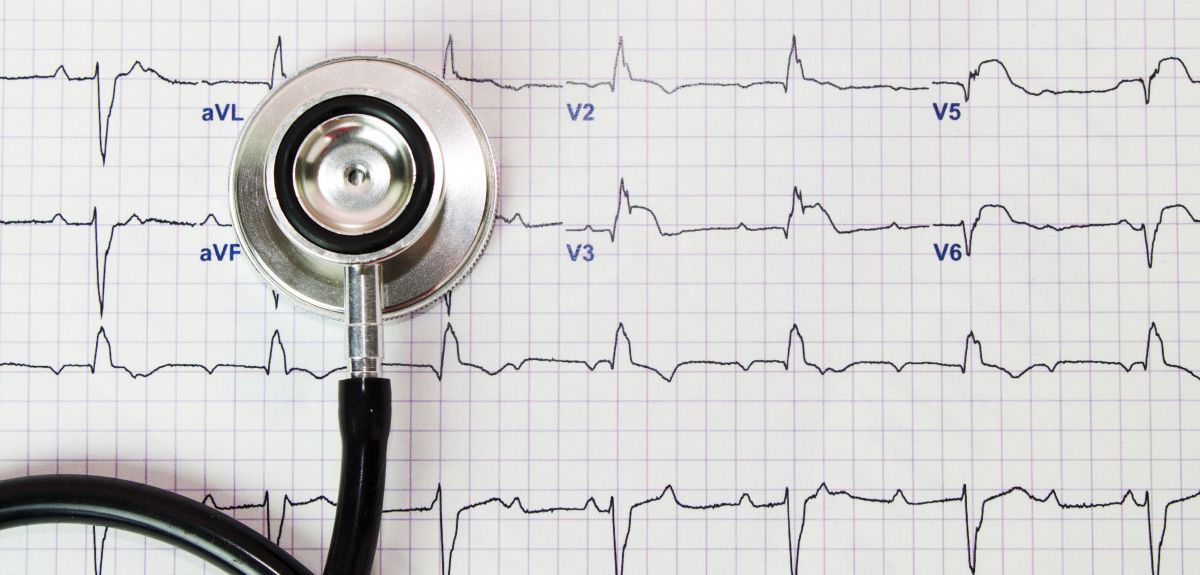 UniofOxford's tweet image. The number of people being diagnosed with #HeartFailure in the UK continues to grow, and the poorest people are significantly more likely to be affected by the condition, new research from @GeorgeInstUK at the University of Oxford has found: po.st/ddPt76