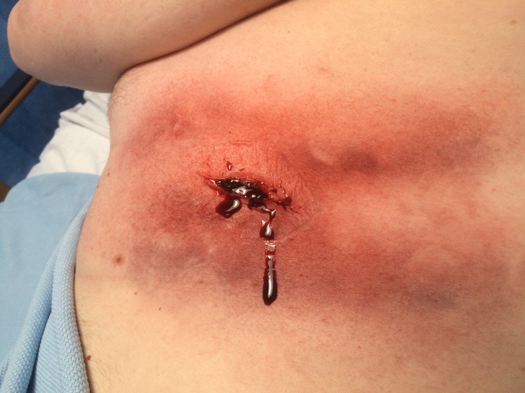 CS4PWebsite's tweet photo. First attempt at the various stages of frostbite and chest injury! Really good weekend assisting with Mountain rescue training @NorthumbriaUni @C4STL_NU https://t.co/Sfsl6oWxx5