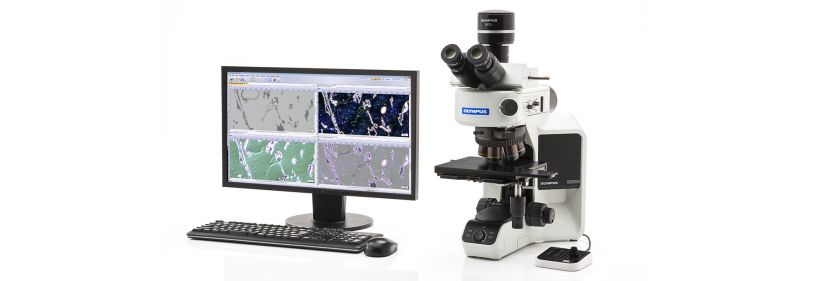 aptexltd's tweet photo. Which #Analysis Method Is Correct for My #Materials Sample?
#science #materialsscience #olympus #microscope #phaseanalysis #porosityanalysis
https://t.co/I0uXd193IA https://t.co/drCR4RZ2lb