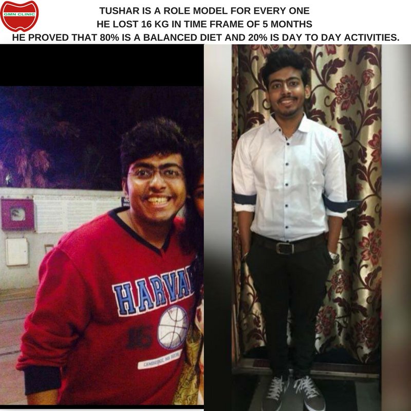 GmnClinic's tweet photo. OUR Role Models for every one who wants to lose Weight.
They all Proved that 80% is a Balanced Diet and 20% is Day to day Activities.
#Motivation #loseweight #RightDiet #NOStarving #RegularDiet by #Dietitian #Nutritionist Geetanjali Ahuja (Mengi)
https://t.co/gWaIg7ZkFb https://t.co/BEb7eu004m