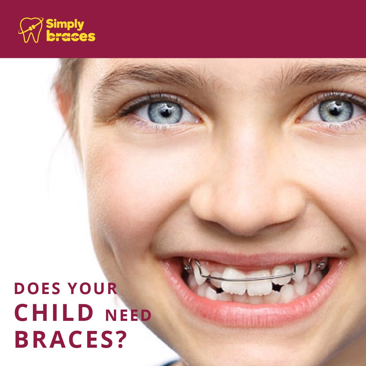 simplybracesIN's tweet photo. Straighten your child's teeth without interrupting their life. Drop in at the center near you to learn more.
#SBSmiles https://t.co/5Ac5FyHuFa
