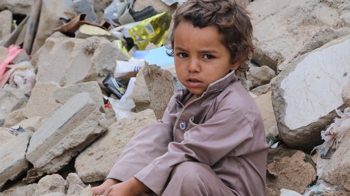UNICEFEMOPS's tweet photo. Conflict. Carnage. Children are not responsible for the conflicts of adults. But they are the most vulnerable victims. https://t.co/rGeFn3zpsj  #Yemen
#ChildrenUnderAttack v/@unicefturk https://t.co/75ljM6Um3I