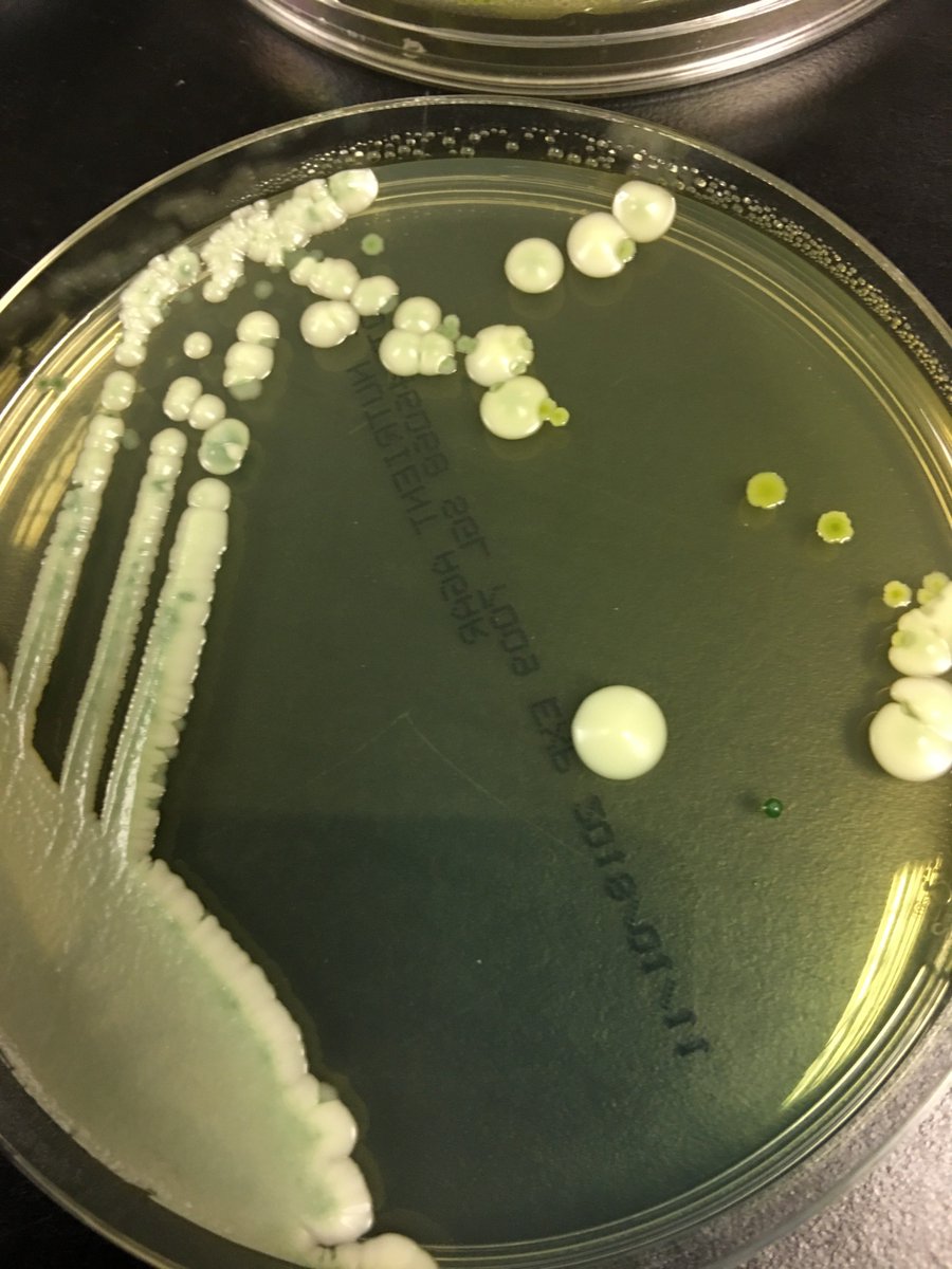 Brewlab_Lab's tweet photo. #BrewCon2017 #Megablend Update 2. We retained a small volume of all samples received at Brew Con for the Megablend, the culturing and isolation of organisms has begun!!!! See more our Facebook page.. https://t.co/s0pDjBY7BA https://t.co/hBXaJj0kaq