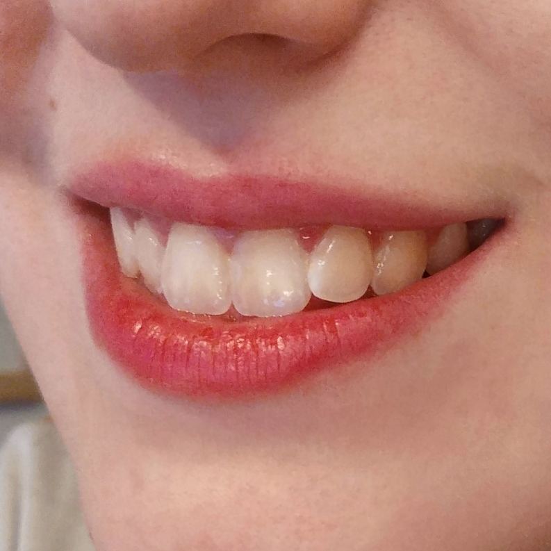 HertallyMakeup's tweet photo. Os dejo unas fotos de uno de mis tintes labiales favoritos, recién aplicado y tras unas horas (ducha incluida 🚿). Es muy cómodo de llevar, el color es precioso, y la duración increíble. 
Más información en mi Instagram 😄📷
#KIKOTrendSetters #RedLips #TinteLabial 💋 https://t.co/CNeML7Kf8E