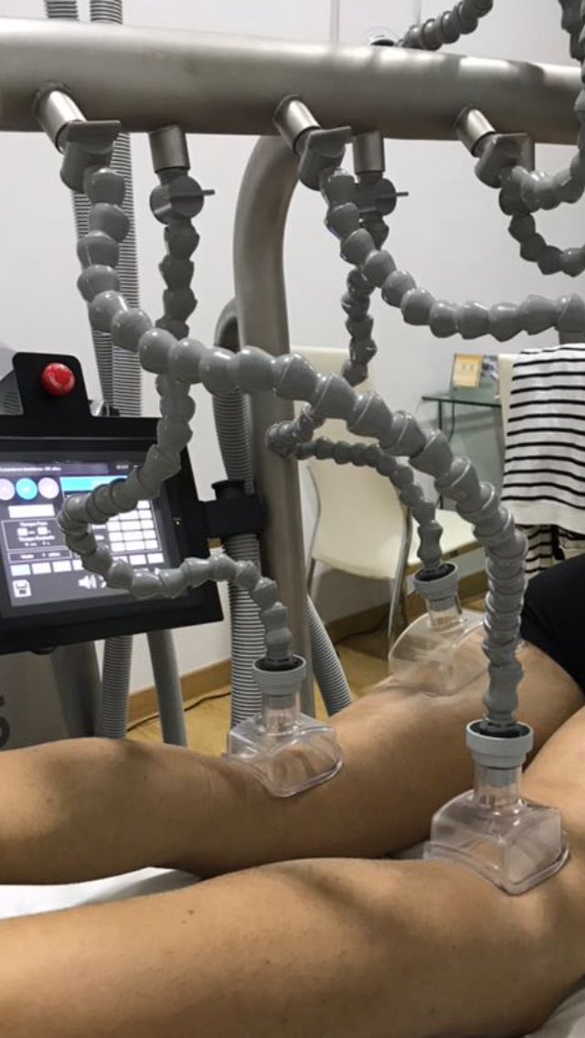 LaloRodriguez14's tweet photo. Pues no hay carrera que no pase por @unifis para los últimos retoques con @rafa_unifis que me deja como nuevo. Ese aparatito, Physium, hace milagros. Gracias por todo Rafa.
#mifisio #physium https://t.co/JqYtxZ8msN