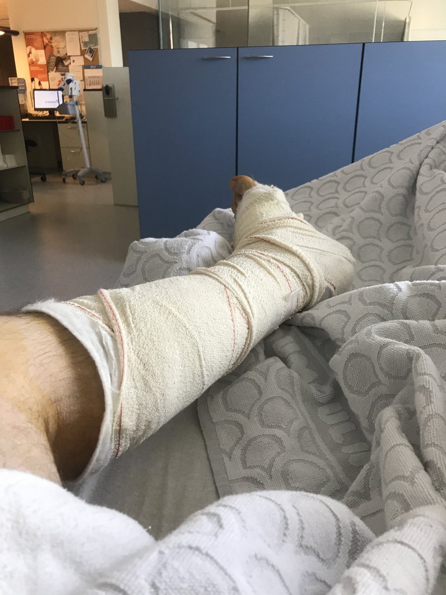 runningsince76's tweet photo. Vandaag slijmbeurs weggenomen. Even gips en dan op naar een top 2018 met de uppies #TeamUp40 #Keeponrunning #Thebelgianuppie #Rslab #AzMonica https://t.co/Azor1YTm6v
