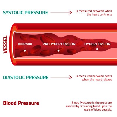 MyHCGProgram's tweet image. Lower Blood Pressure = Longer Life: A recent study published in the New England Journal of Medicine suggests that most people should keep their BP below 120/80 mmHg for a longer life. Fortunately there are ways to reduce blood pressure naturally ht.ly/bUnG30gKSZj