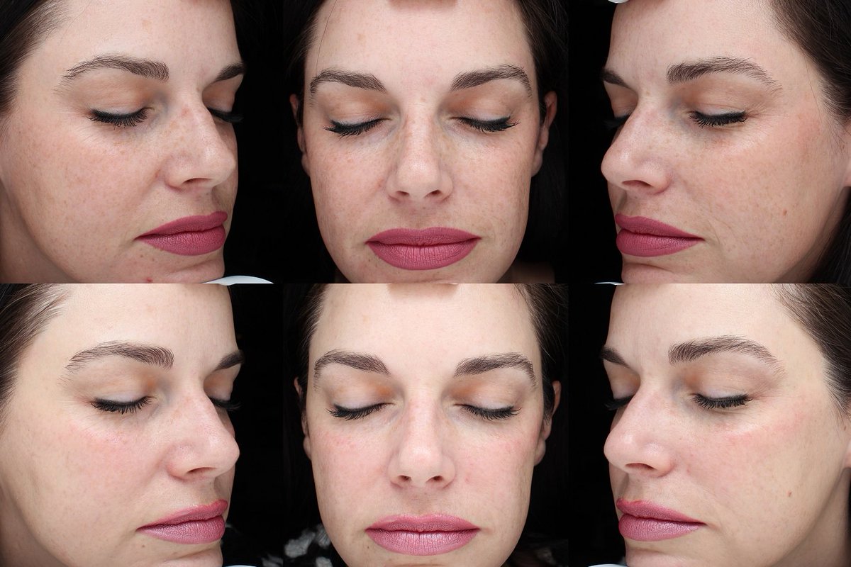Sullivan1K's tweet photo. Call Today For Your #AdvancedCorrectivePeel #SkinCeutical 410-571-1280 https://t.co/4Xe0MEyzaO