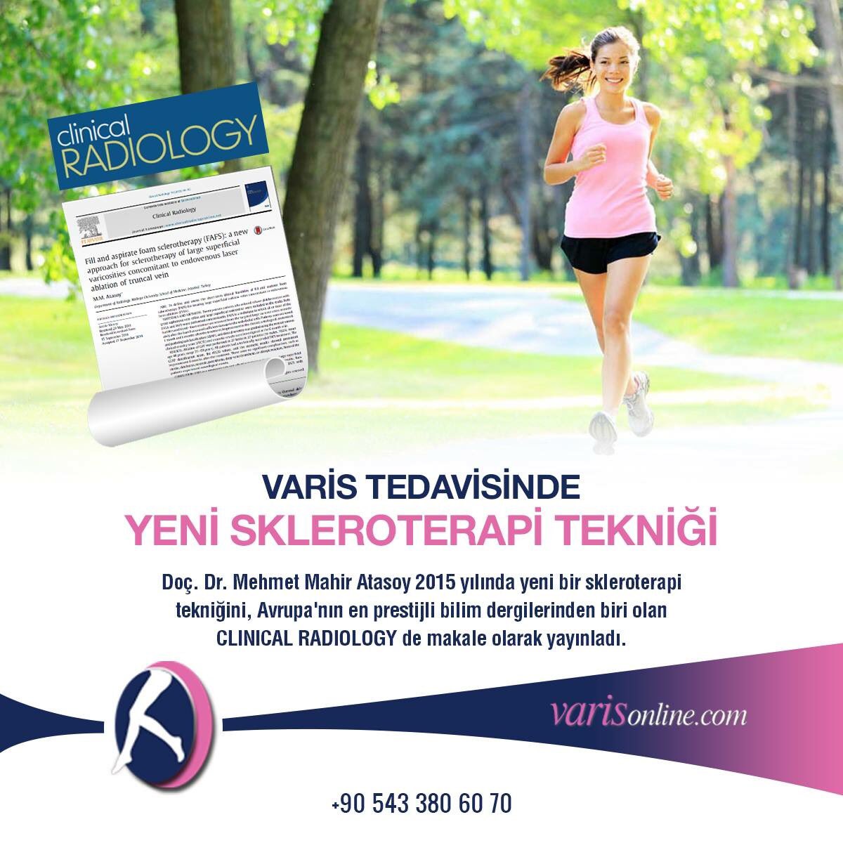 Doç. Dr. Mehmet Mahir Atasoy 2015 yılında yeni bir skleroterapi tekniğini, Avrupa'nın en prestiji bilim dergilerinden biri olan CLINICAL RADIOLOGY de. 
varisonline.com/varis-tedavisi…   #varisonline #varistedavisi #skleroterapi #clinicalradiology #varis