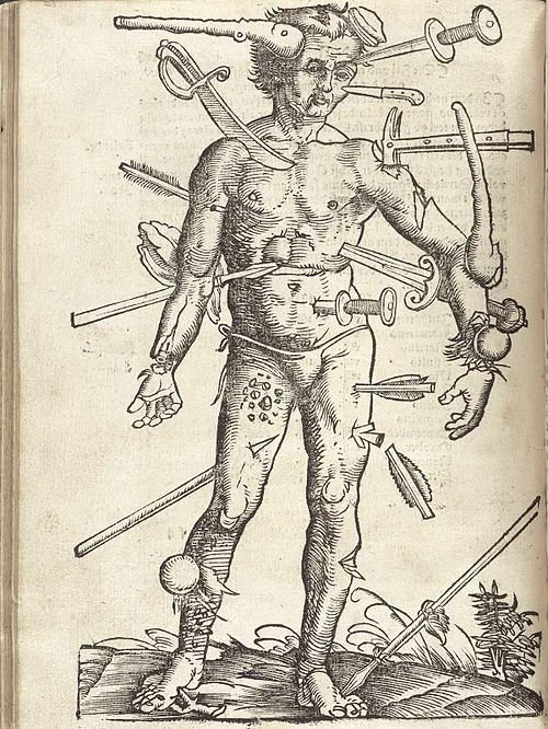 all the teens want nowadays is jokes about old-ass medical illustrations
https://t.co/dVT94MVKES 