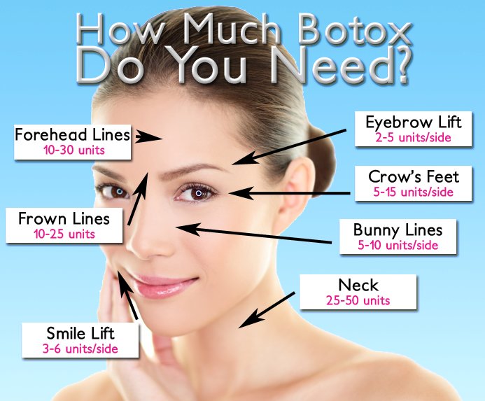 TXBreastBody's tweet photo. Have you been considering Botox, but unsure of how many units you may need? Although each individual will require a different amount based on their unique appearance, this serves as a great guideline on what you can expect.
#HoustonBotox #Botox https://t.co/lhUdAXrnrT