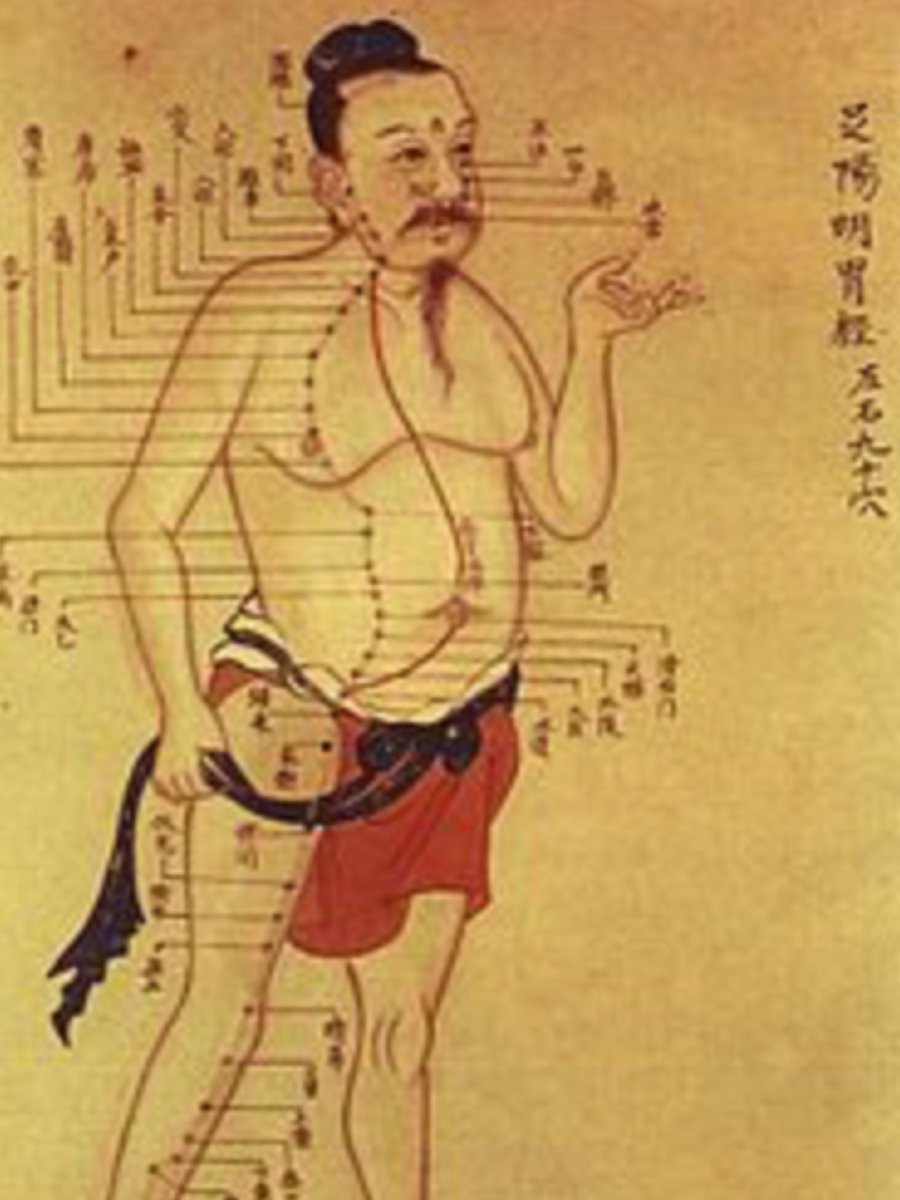 AliNaji46's tweet photo. Old #Chinese_Medicine was innovative in many  #medical_therapies. It sounds odd, but they treated faecal diseases w diarrhoea by feeding patients w a soup of healthy stool 🤮. Now, it proved 2 b a successful therapy 4 resistant #C_Difficile infection instead of #antibiotics. #FMT https://t.co/b8jYSd29Wa