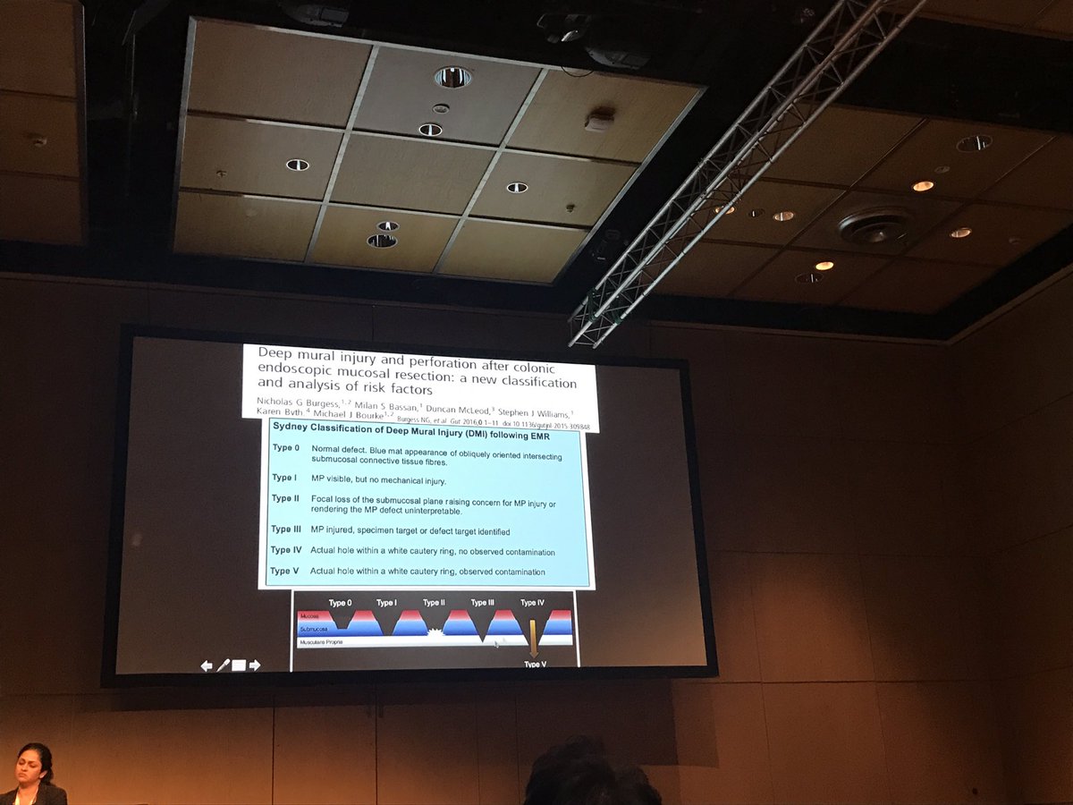 ZoeRaos's tweet photo. #Gastro2017 #bluewhalesign #DMI #targetsign #postEMRdefect #topicalsubmucosalchromoendoscopy https://t.co/b5APc2yB7P