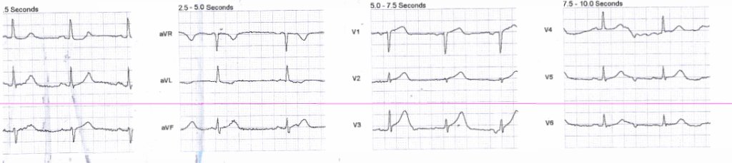 Bart Cresswell tweet media