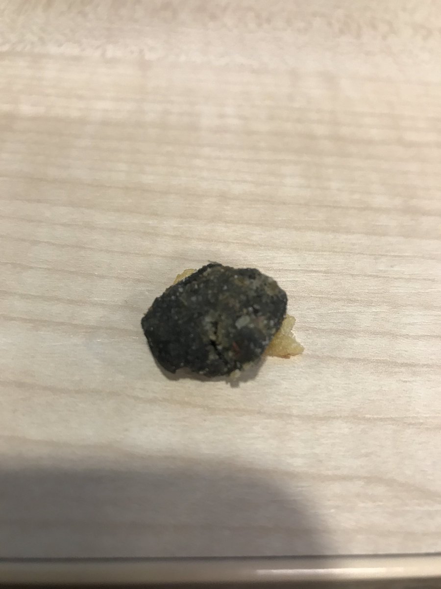 lukej91's tweet photo. Just found this in my pack of @MrTaytoNI not sure what it is but I’m pretty sure I shouldn’t eat it! https://t.co/IzUzcwdANl