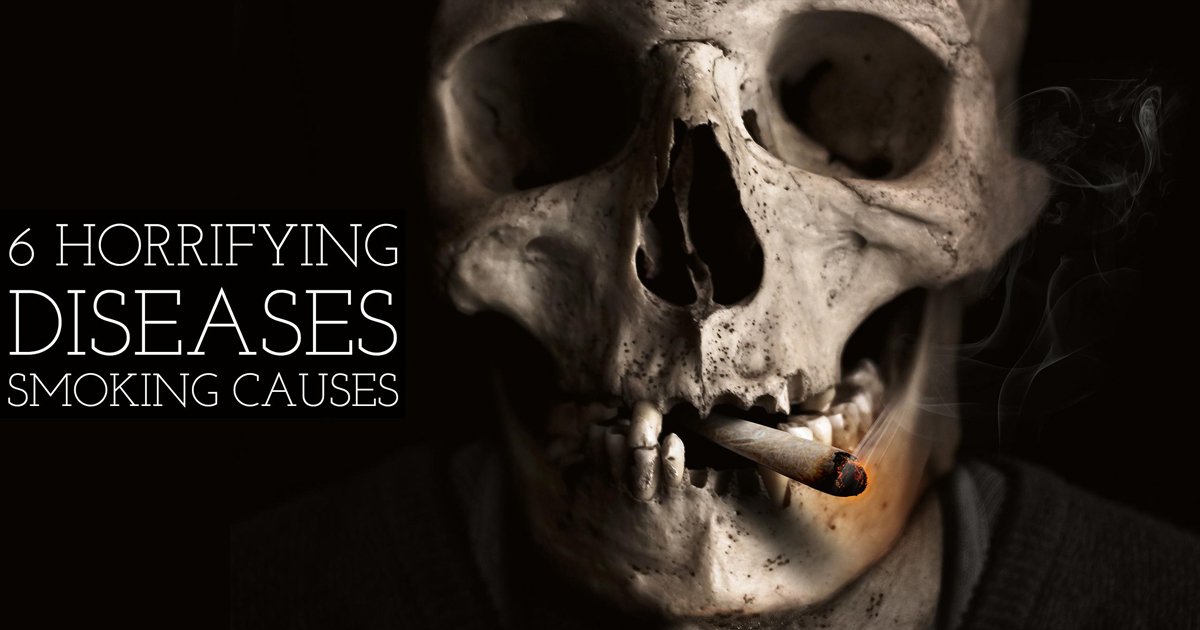 HnFTipsOnline's tweet photo. After reading this you may have a second thought about lighting the next one!
Read the complete Article at - https://t.co/g0iDZRnrIM
#smoking #ThursdayThoughts #cigarette #Smokingkills #livehealthy #stayfit #healthandfitnesstipsonline https://t.co/iBu8JvXRWO