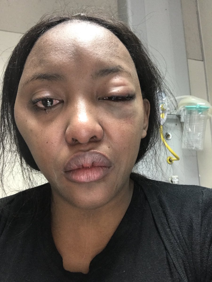 Dnee_L's tweet photo. This is Kevin Malila, the guy that attacked me over a parking spot a few months ago at a garage. He failed to show up for his court appearances and a warrant for his arrest has been issued. If you have seen him please report him to a police station. Please help me get justice. https://t.co/lhHzgSaHpy