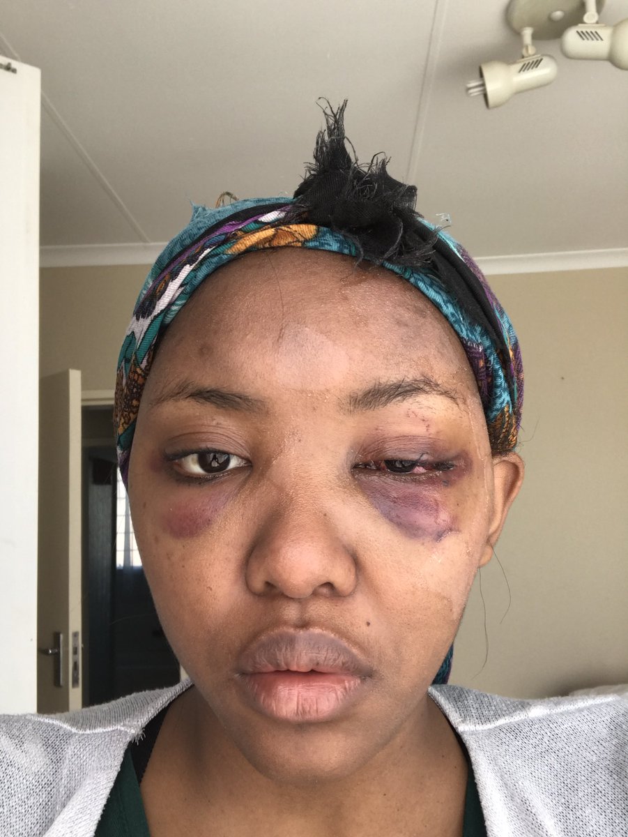 Dnee_L's tweet photo. This is Kevin Malila, the guy that attacked me over a parking spot a few months ago at a garage. He failed to show up for his court appearances and a warrant for his arrest has been issued. If you have seen him please report him to a police station. Please help me get justice. https://t.co/lhHzgSaHpy