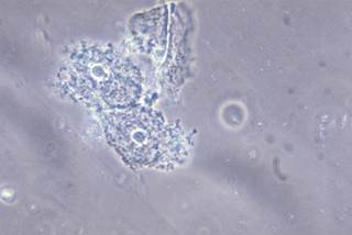InfectDiseaseAd's tweet photo. #FDA Approval: Single-Dose Oral #Therapy for #Bacterial #Vaginosis https://t.co/oCBk03asJG #Solosec may be co-administered with combination oral #contraceptives as no clinically significant #drug interaction was seen. @Symbiomix @US_FDA #Symbiomix https://t.co/pci1Gg81dw