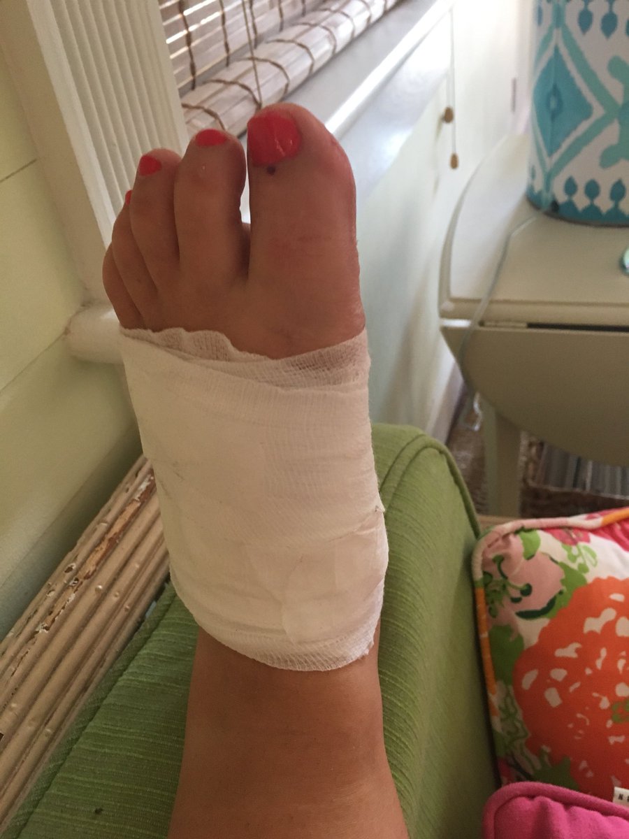 ellemoxley's tweet photo. Funny story about cooking Thanksgiving dinner ...
#SoIDroppedAKnife
#6Stitches
#PulledOffTheMeal
#AMonthInKeyWest https://t.co/EMd7WNw29o