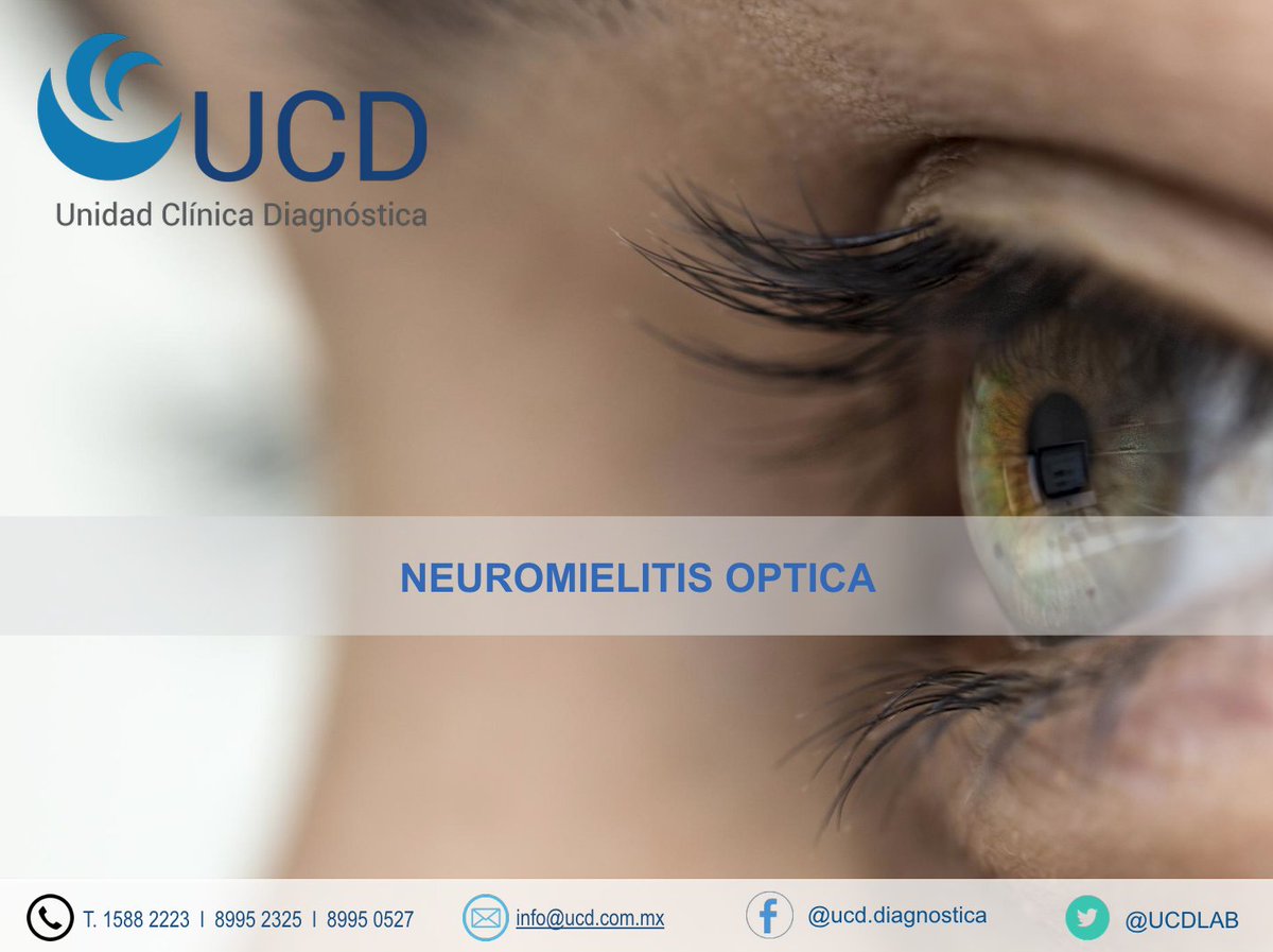 UCDLAB's tweet image. facebook.com/ucd.diagnostic…