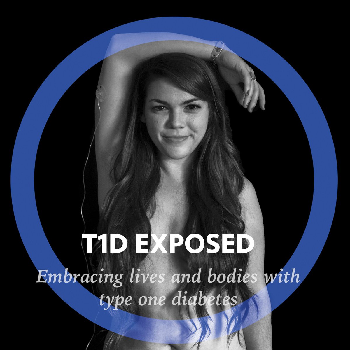 t1dexposed's tweet photo. Here at T1D Exposed, we founded the project to shed the shame of #t1d and connect to the community around the world.  Thank you this Thanksgiving for helping us do so! Support the project: https://t.co/c1emEYFHBg https://t.co/gAfIBhIpoQ