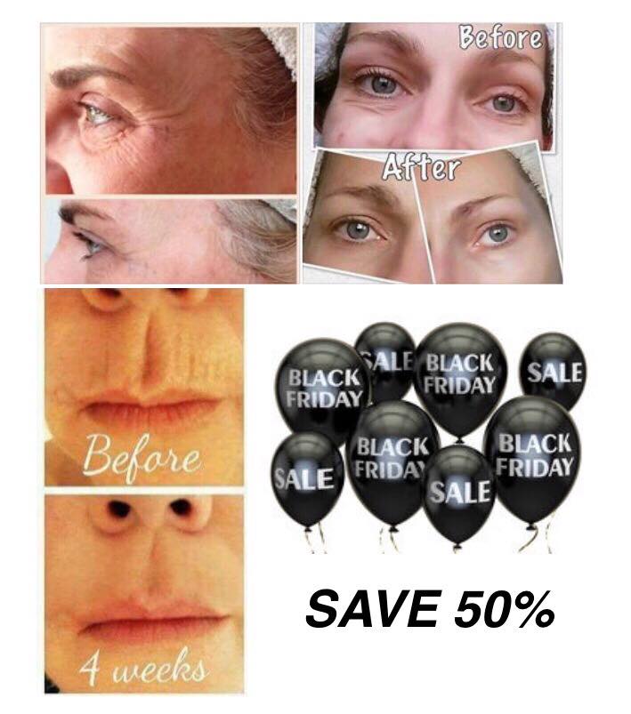 KCSERVICES95's tweet photo. 💕 BLACK FRIDAY💕
ALL ORDERS MUST BE IN TONIGHT, SAVE A HUGE 50% 🙌 Hate your lines? Then your lines will hate this 😲👀 GOING GOING GONE... https://t.co/NiW4gSRN6w