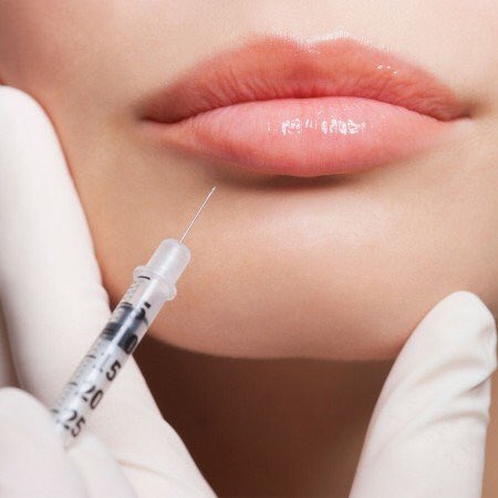 DermaFillersBR1's tweet photo. Are #lipfillers painful? Is #Botox safe? Find out here https://t.co/T4yZfoIoHR
#aesthetics #beckbromFL #bromley https://t.co/rnyV1sizU4