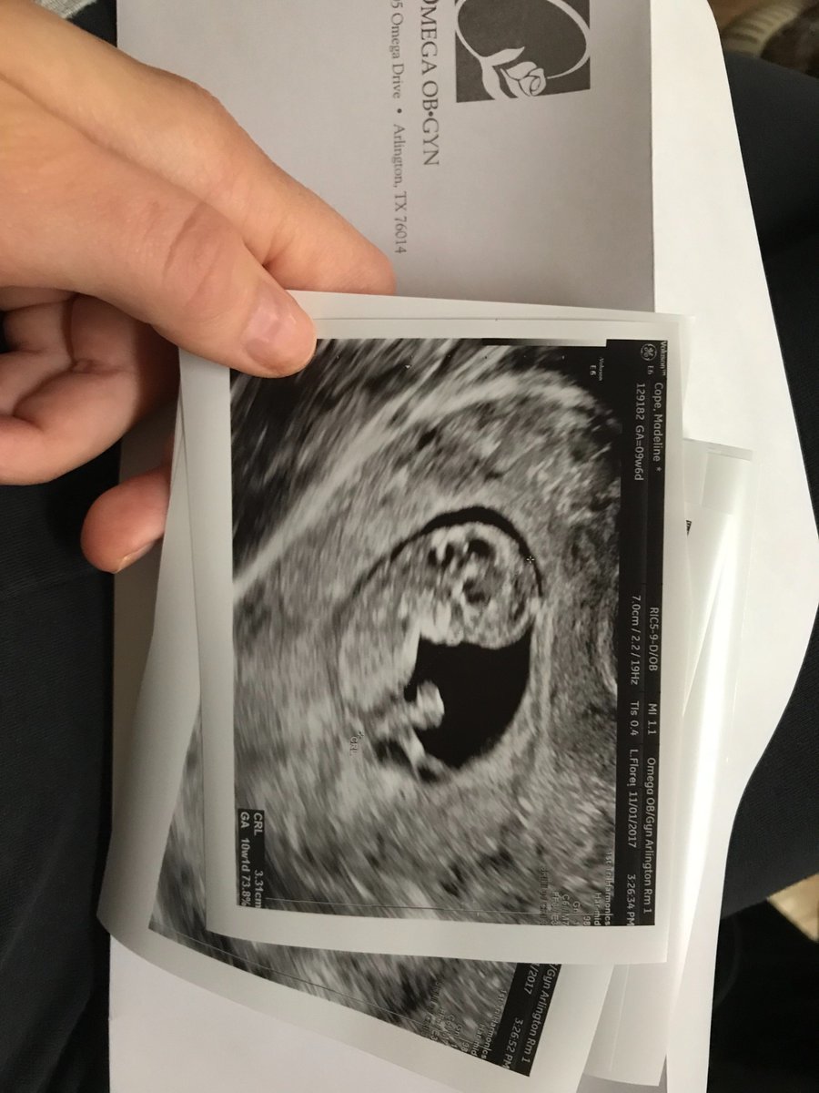 MaddyCope1's tweet photo. My precious blessing coming May 2018 👶🏼❤️ So thankful! https://t.co/FPIl4TgpVh