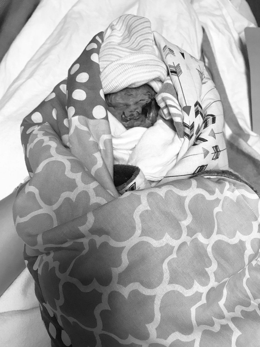 JennaBrett13's tweet photo. Our baby girl is no longer suffering and is in the perfect hands of Jesus. Thank you, Lord, for giving me and Tyler strength and comfort. We love you, Cara Jean. Thank you for fighting this long. 💕 11.23.17  #26weeks https://t.co/HsJ3adH1r4