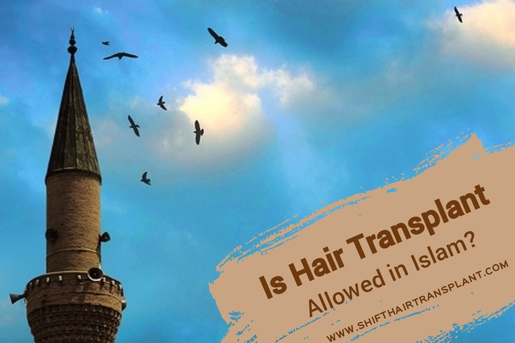 shifthairtr's tweet photo. #Is_Hair_Transplant_Allowed_in_Islam
https://t.co/68grzqZ6PD 

#DHI_Hair_Transplant #FUE_Hair_Transplant #Hair_Transplant #Hair_Transplant_for_Women #Women_Hair_Transplant #Hair_Transplant_in_Istanbul #Beard_Transplant #Eyebrow_Transplant #Hair_PRP #Hair_Restoration https://t.co/VFTuxRzfwI