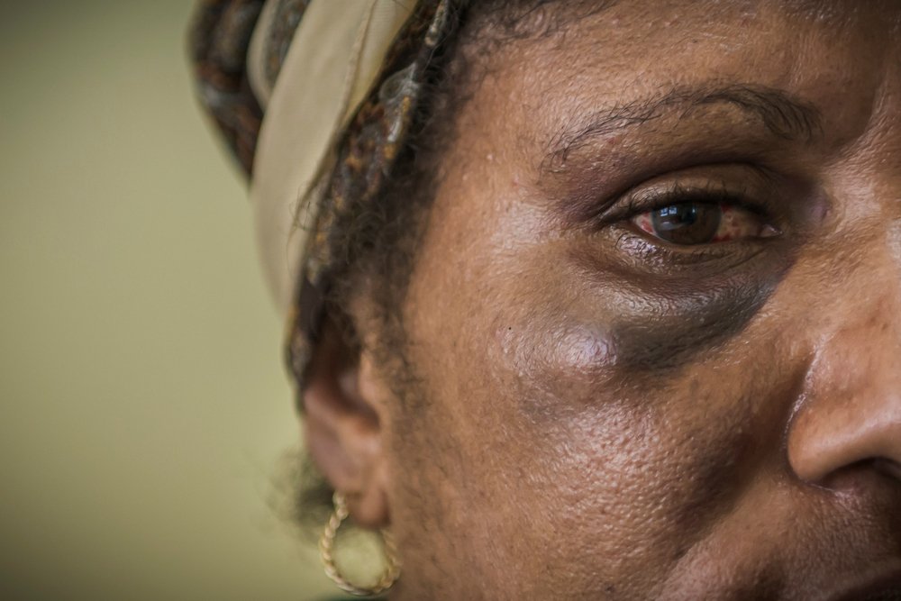 MSF_ITALIA's tweet photo. 1 donna su 3, a livello globale, ha subito una violenza sessuale. Ogni giorno ci impegniamo affinché la sofferenza delle vittime non resti inascoltata. #violenzadonne https://t.co/CWc8tIEElK