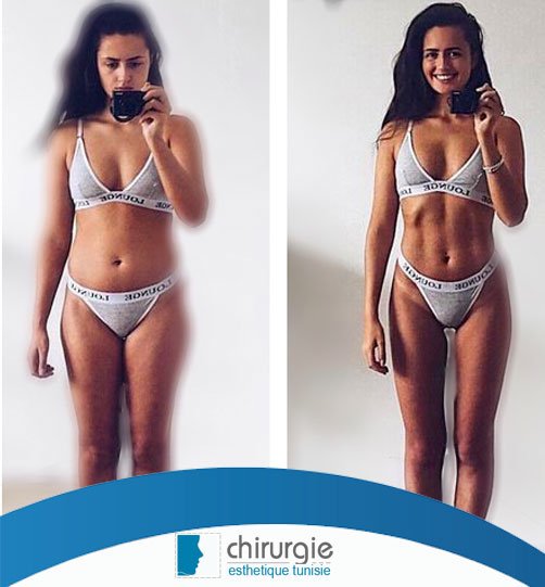 clinique_tunis's tweet photo. découvrez ce qu'il faut savoir sur la #liposculpture avec le #Dr_Atef_Ghedira, #chirurgien_esthétique en #tunisie .
Tout sur : https://t.co/VnfEMiFRpm https://t.co/ET8XUxmUy9