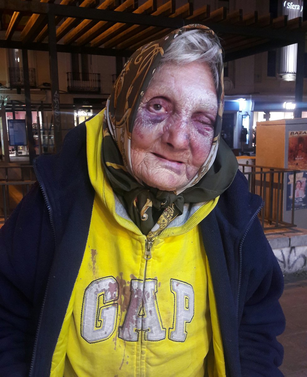 AntifaMadrid's tweet photo. Flor, una anciana de 84 años, desamparada, duerme en la calle Fuencarral.
Ayer 4 cobardes fascistas le propinaron una paliza.
No son personas, son basura y hay que limpiar nuestra ciudad. https://t.co/1SUUccOuyX