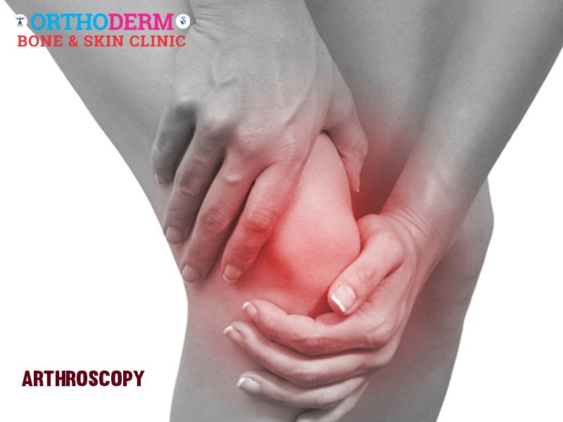orthoderm_'s tweet photo. Knee arthroscopy is an effective tool for diagnosing your joint condition and for confirming treatment for knee problems.
Book an Appointment ++91-9840866029
#orthopedic #Skin #clinic #treatment #healthcare #health #JointDislocation #joint #fractures
https://t.co/R90DV4SQvU https://t.co/H9RERacpUZ