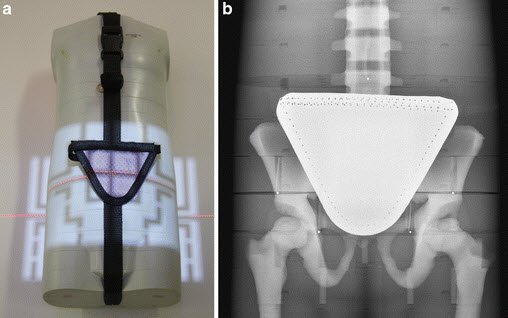 Online now:
Female gonadal shielding + automated exposure control for pelvic xrays = not a great match
ow.ly/e9Op30g3TCH
#PedsRad