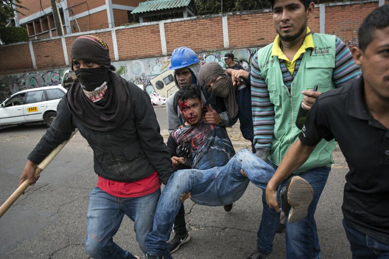 Marcos100tifik9's tweet photo. #PrayForHonduras #Hail100cia @HCHTelevDigital  
perrus mi hermano fue herido por una bala esta apunto de morir 
Dejen su amen para que reviva. https://t.co/AdWVWGLZKq