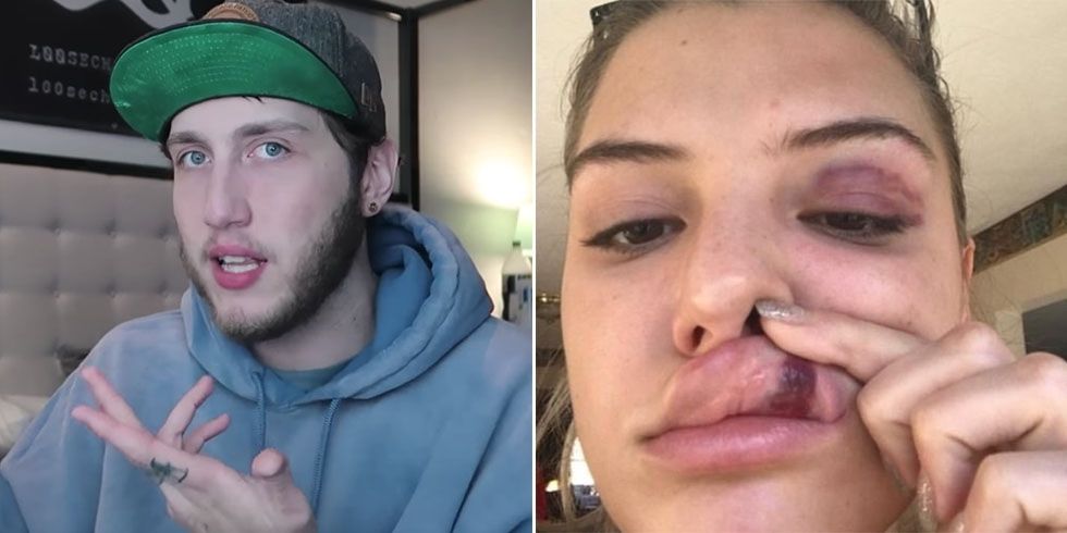 FaZe Banks Opens Up About the Night Alissa Violet Was Punched In The Face h...