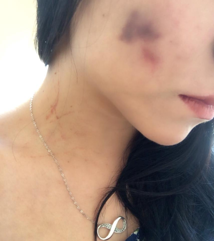 PublimetroMX's tweet photo. ¡No pude ser😡! Porrista de Saraperos muestra y denuncia agresiones por parte de su novio

https://t.co/7IeTmhSR0m https://t.co/UbHOVT3oB1