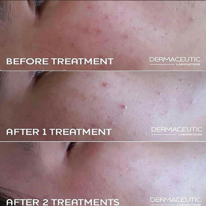 OrchardSkin's tweet photo. A #Dermaceutic Treatment will help you regain confidence in time for the festive season! https://t.co/WJ2jl6RT0t✨ https://t.co/vVaUv2uCuJ