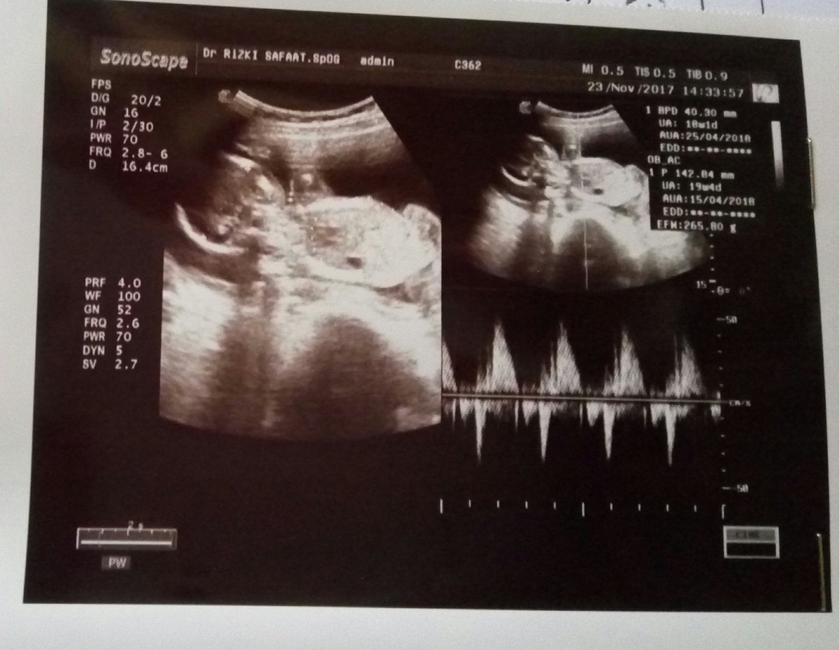 irmaokta30's tweet photo. 💜❤💙 #18weekspregnant https://t.co/nDCNHZnY98