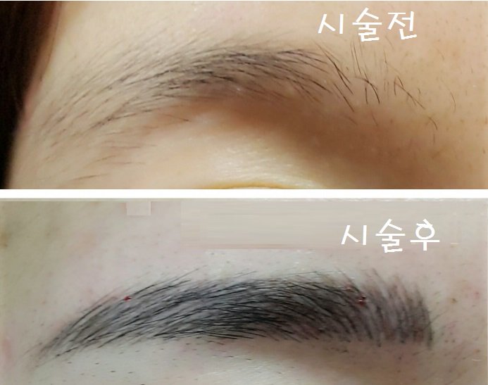 #자연눈썹#안산영구화장#시흥3D눈썹#안산눈썹#시흥눈썹문신#출장시술#안산자연눈썹#시흥자연눈썹#안산엠보#시흥엠보#출장5만원#눈썹문신제일싼곳#3D눈썹문신5만원# 카톡 상담 japan77