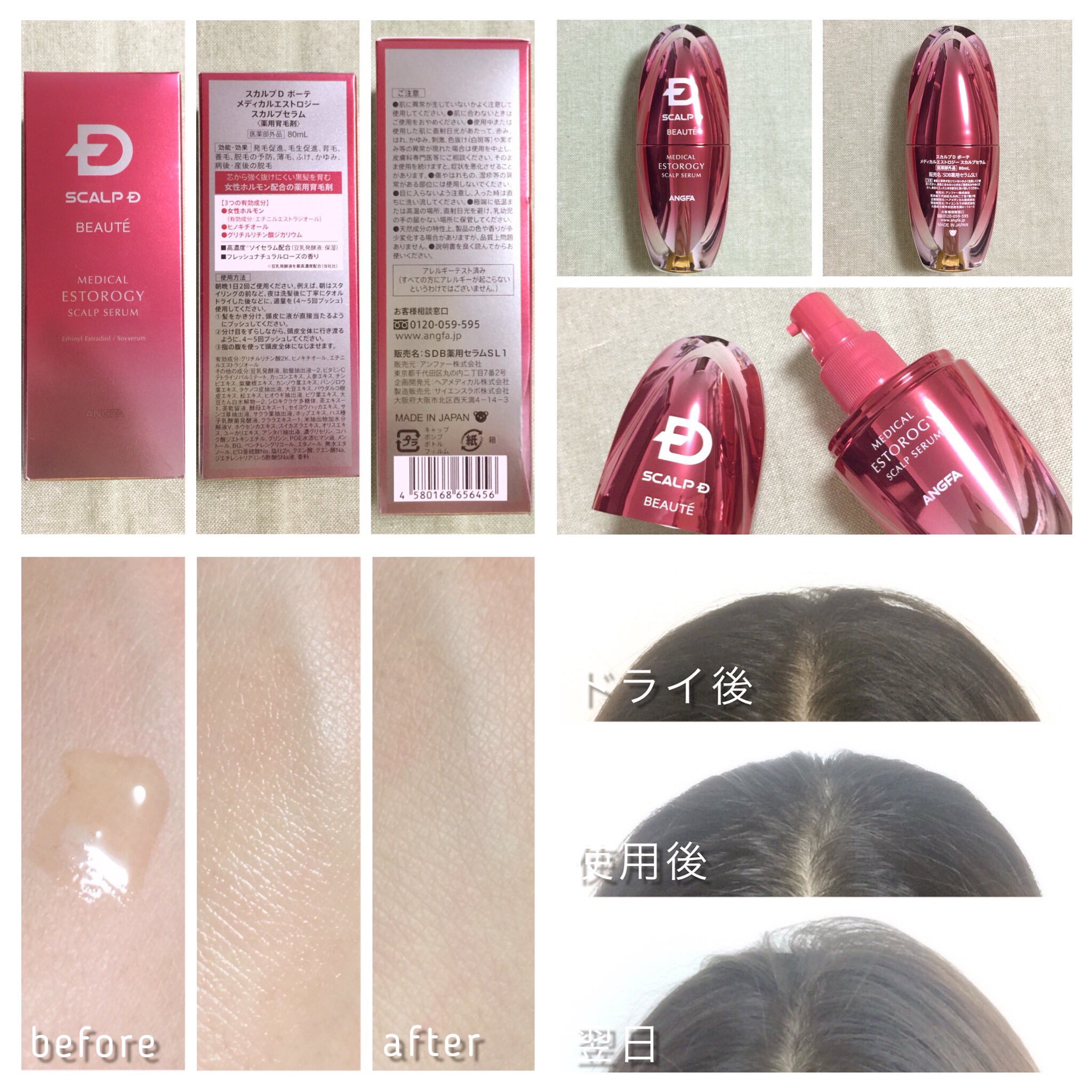 初回限定お試し価格】 スカルプD ボーテ メディカルエストロジー