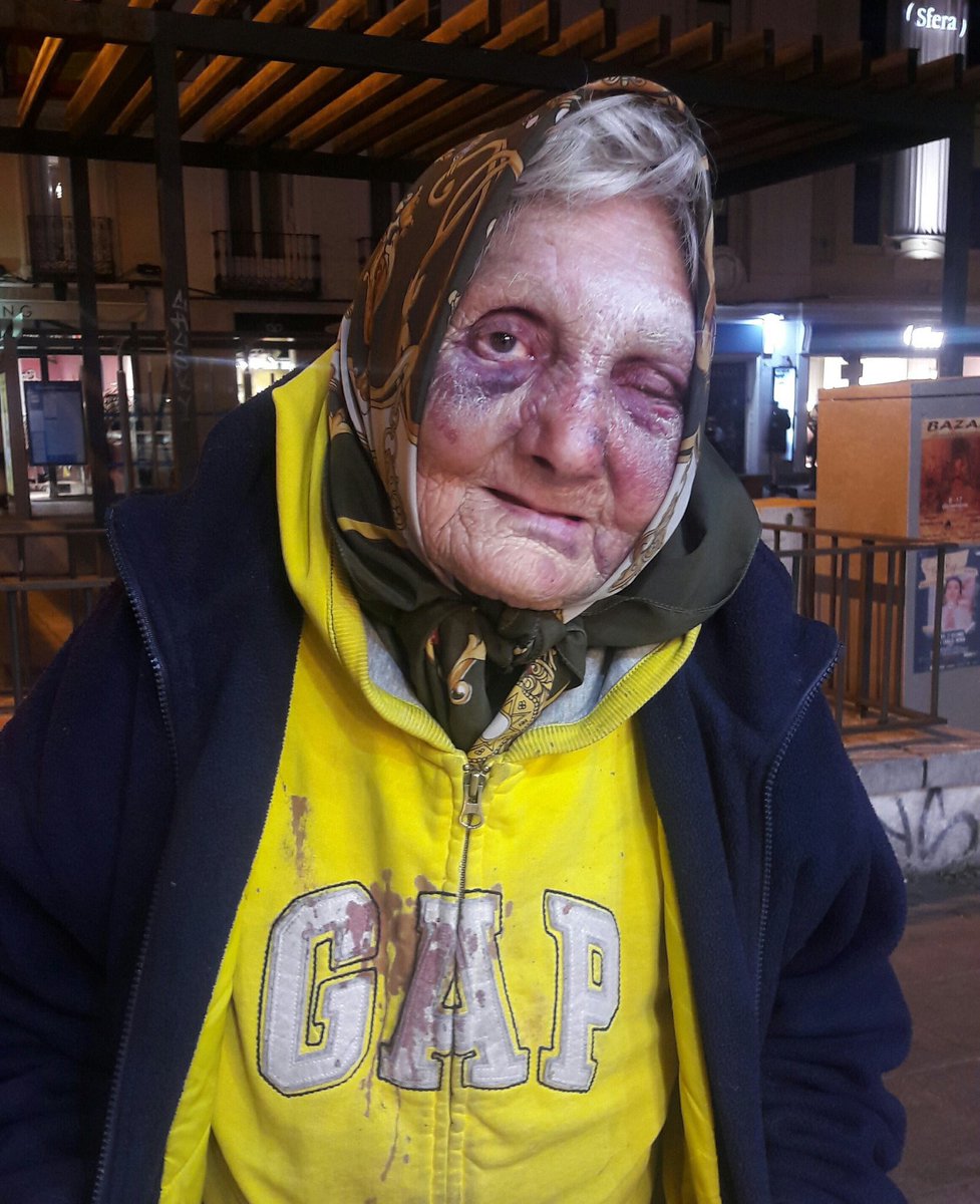 VaqueroEH's tweet photo. Si los 4 individuos que apalearon a esta mujer quieren limpiar las calles de gentuza lo único que tienen que hacer es suicidarse https://t.co/kIJZ8SDblq
