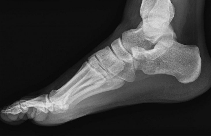 Int_Negocios's tweet photo. DESARROLLAN SOFTWARE QUE AYUDARÁ A CIRUGANOS PARA REPARAR FRACTURAS ÓSEAS.
El programa computacional...

https://t.co/XNNNgtAj2J https://t.co/uYo6iHlD1R