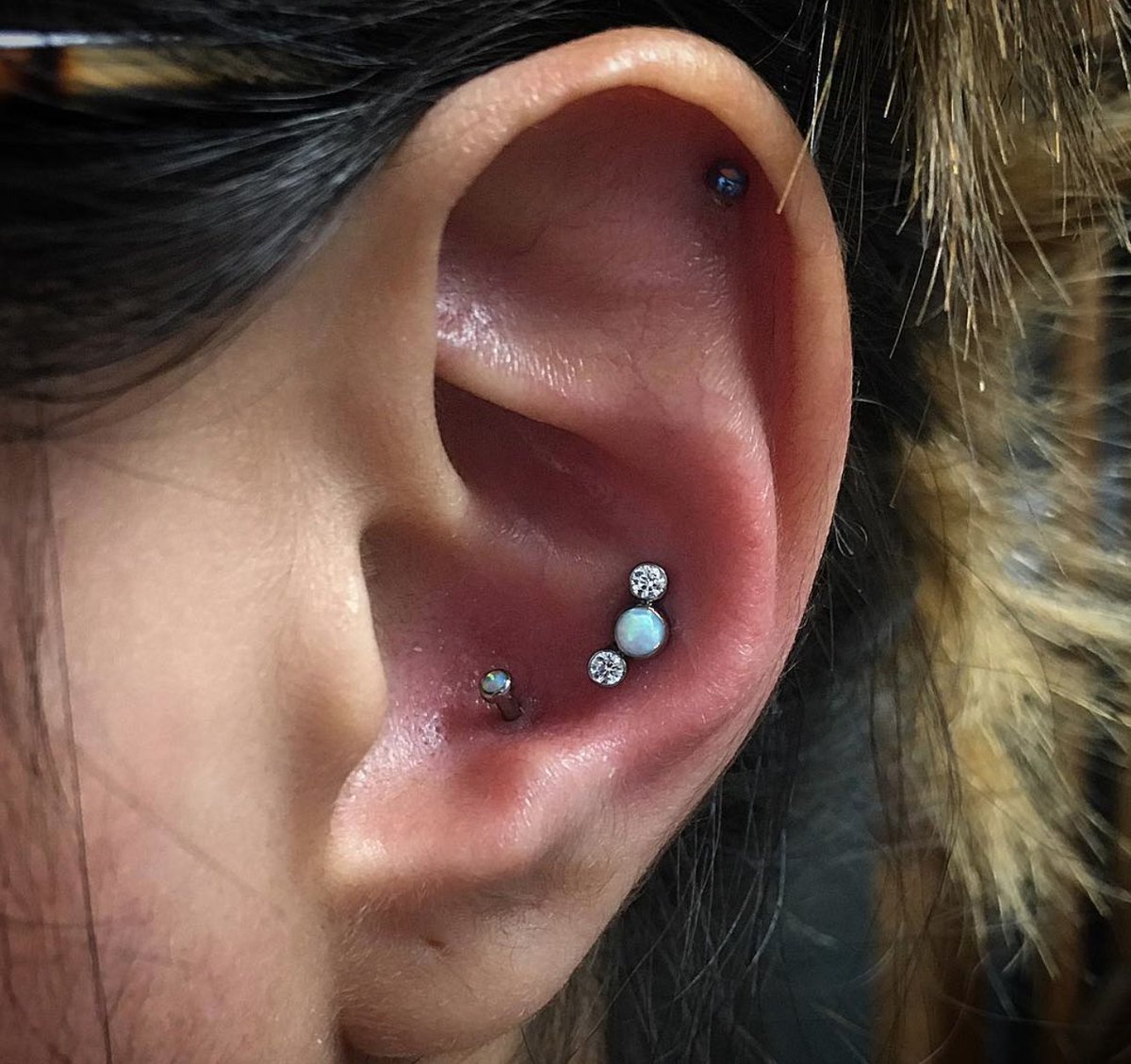 Just one treatment deep and this crescent moon is already on it's way out! That's the magic of our <a href="/picosure/">PicoSure</a> tattoo removal system.